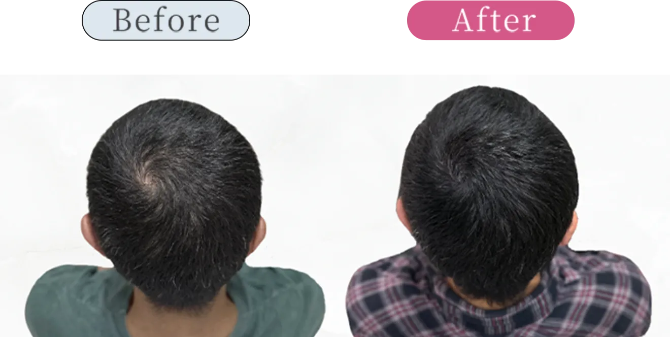 症例1 Before After