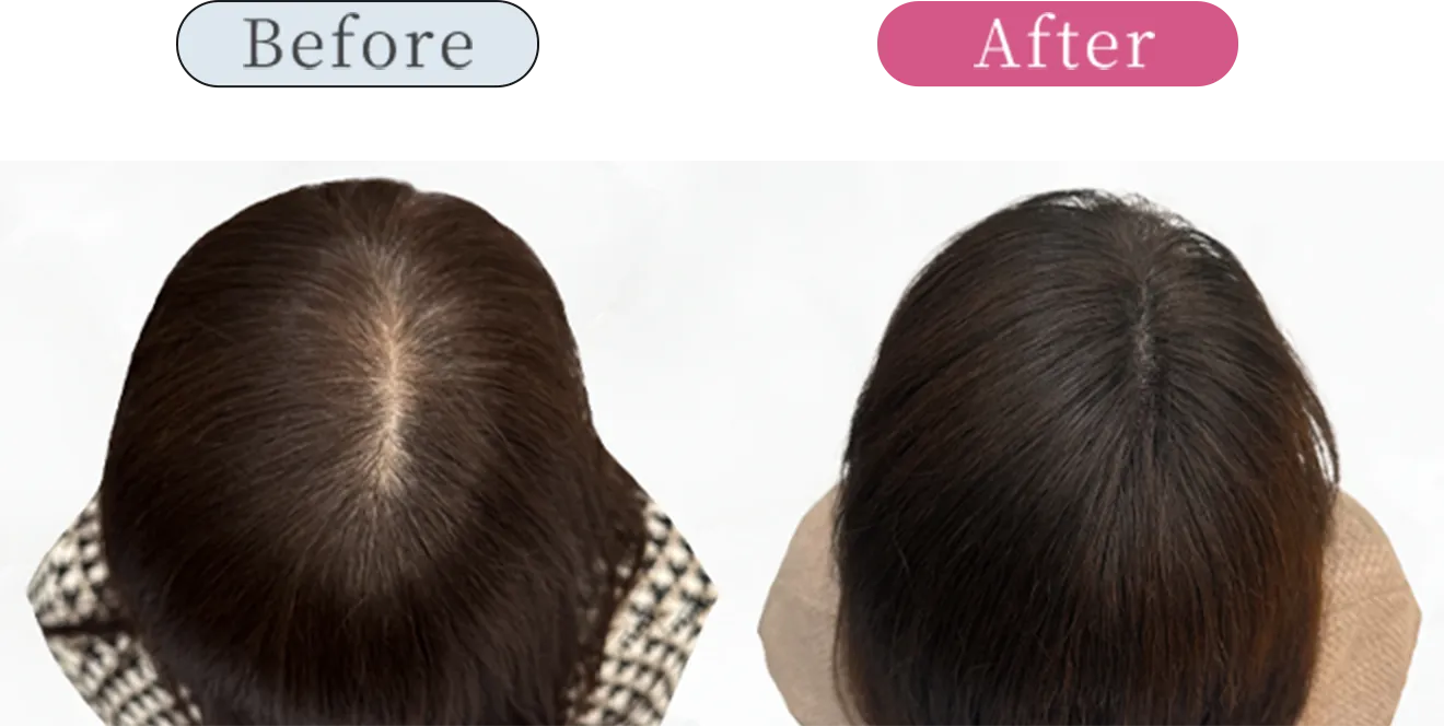 症例2 Before After