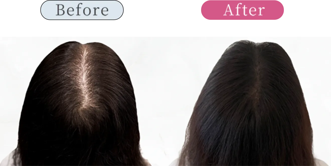 症例3 Before After