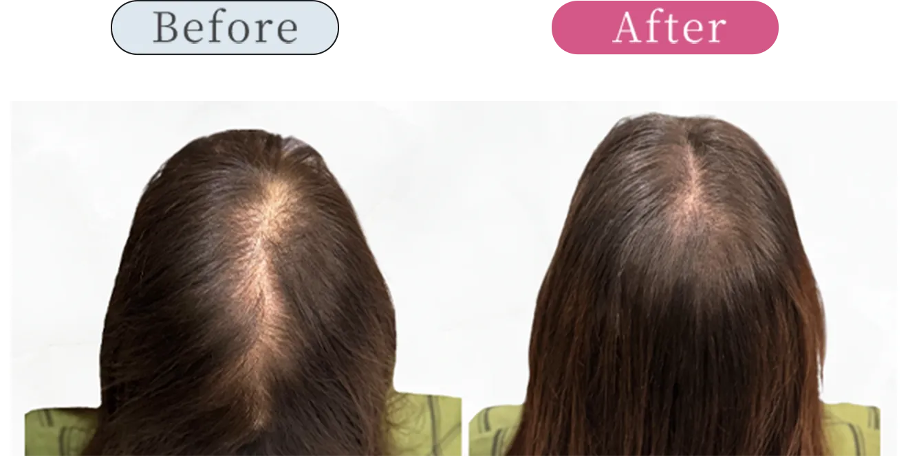 症例4 Before After